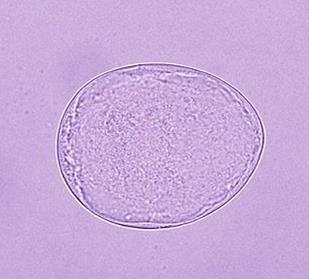 Parasitology, Author Prof. A.E.
