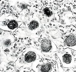 FGS: dg. cytologické vyš.