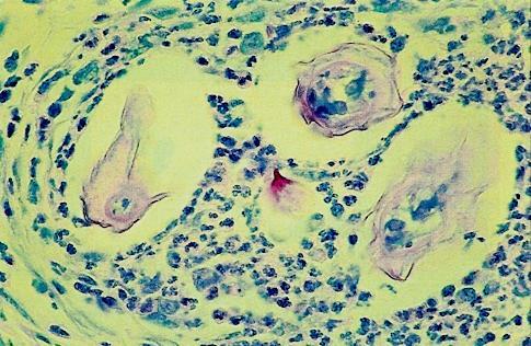 HISTOLOGIE Spolehlivá pouze v případě, kdy řez proveden
