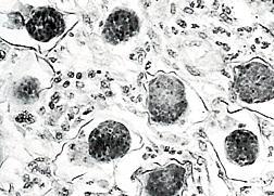 FGS: HISTOLOGIE, CYTOLOGIE + NATIVNÍ PREPARÁT
