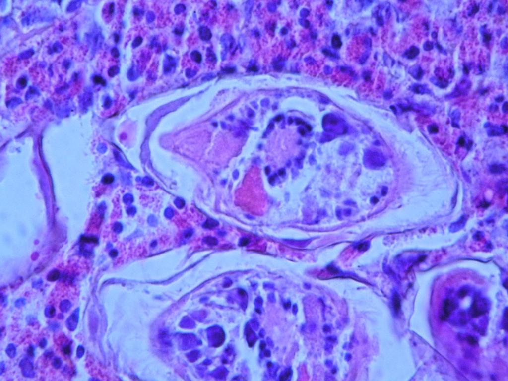 HISTOLOGICKÝ NÁLEZ H&E