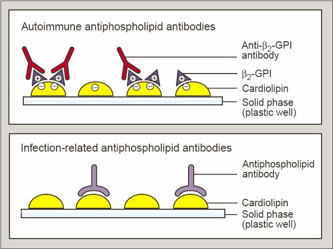 Mnoho laboratoří do svého testování kromě ACLA zařadilo kompletní panel několika nejběžnějších antifosfolipidových protilátek jako protilátky proti fosfatidylserinu, kyselině fosfatidové,
