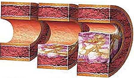 intracelulární komponenty a molekuly, které hrají roli při procesu mechanotransdukce (integrin, aktin-myozinové motory, jádro, extracelulární matrix a mnoho dalších komponent a signálních molekul).