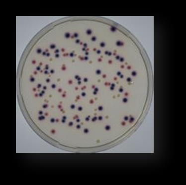 Bakteriálnu suspenziu prekryjeme dostatočne ochladeným agarom (20 30 ml agaru) podľa