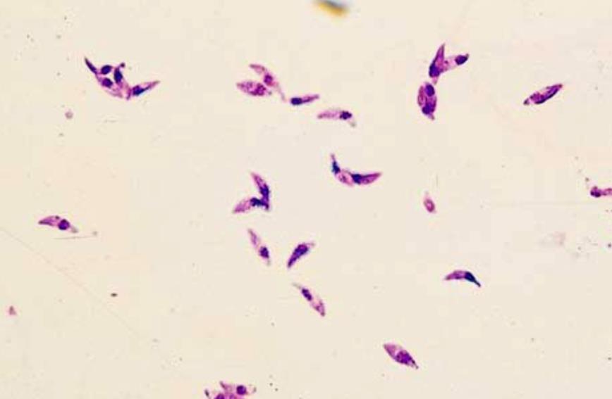 Toxoplasmosa Toxoplasma gondii - infekce orální
