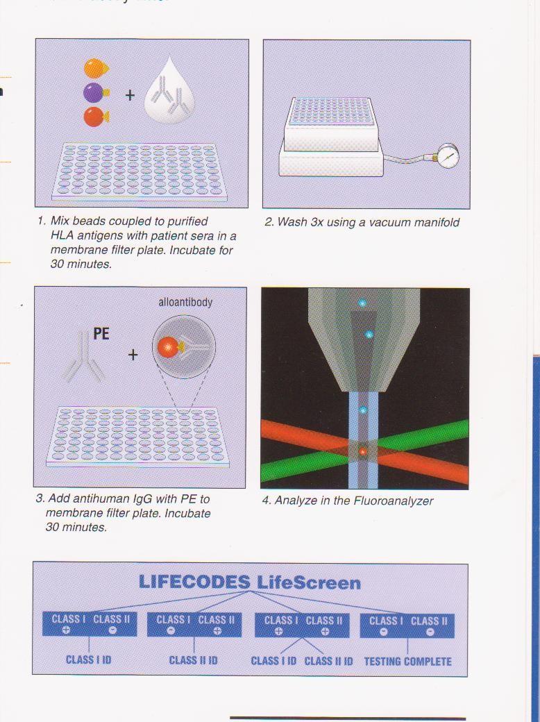 Detekce anti-hla protilátek technologií Luminex Barevně značené mikročástice s navázanými HLA antigeny Inkubace