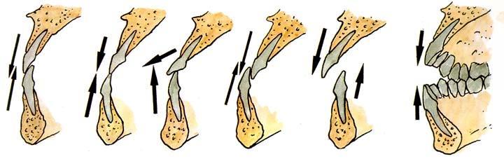 psalidodontia labiodontia stegodontia progenia hiatodontia Chrup jako celek mordex = chrup ortodentní postavení zuby svisle skus (occlusio) = okluze 80 % psalidodontia (nůžkovitý skus) = norma