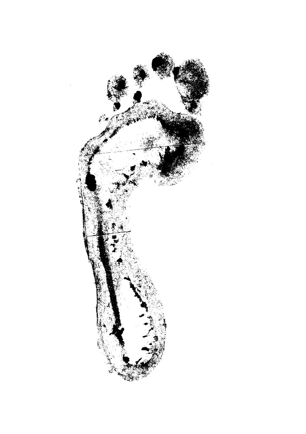 Příloha 29 - Plantogram levá noha