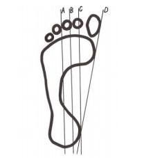 Pokud dojde ke styku či překrytí linie otiskem nohy, tak se jedná o podélně plochou nohu.