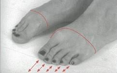 Píďalka jedná se opět o posilovací cvik, ale tentokrát svalů chodidla. Pacient nechá nohy položené na zemi a provádí ohýbání základních kloubů prstů, kdy prsty jsou extendované.