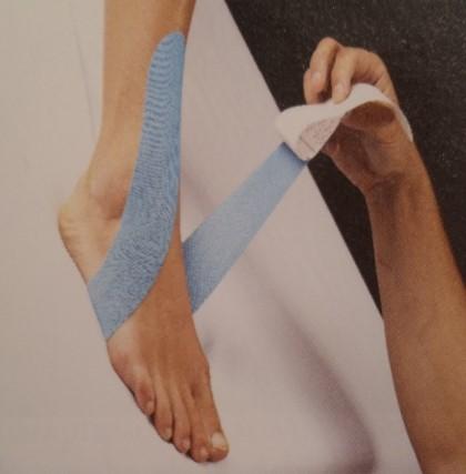 Jako další možnost lze využít tape k aktivaci funkčního třmenu nohy, který zahrnuje musculus peroneus longus a musculus tibialis anterior.