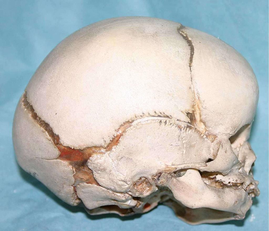 Fetální lebka Norma lateralis