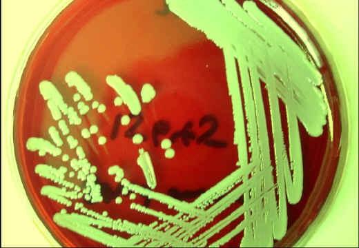 Staphylococcus aureus (MRSA)