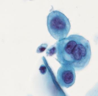 CINtec PLUS Cytology: