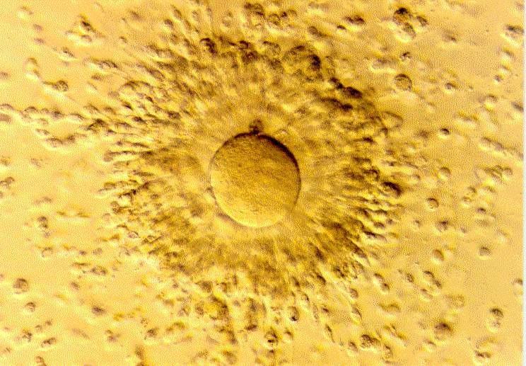 Ovulace Vyšetření hormonální hladiny ultrazvukové vyšetření