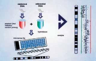 Pomûr fluorescenãních intenzit urãuje oblasti na chromosomu, ve kter ch do lo ke ztrátám nebo zmnoïení genetického materiálu. B. Stejná hybridizace dvou rozdílnû znaãen ch genomov ch DNA s DNA ãipem.