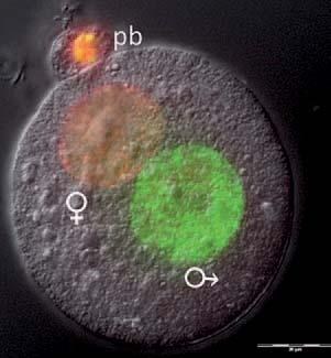 Towards New Life Let Men Be Fertile! group is involved in characterization of reproductive parameters modified due to Diabetes mellitus and selected environmental factors.