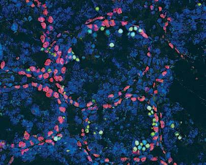 The outcome of this research led already to several prototypes and commercial kits production, serving as tools for identification of sperm parameters in Centres of Assisted Reproduction.