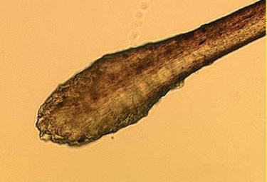 Telogenní effluvium /chronická noxa/ léky hormonální poruchy (hypo i hypertyreoidismus) výživa (Zn,Fe, proteiny) vrozené poruchy