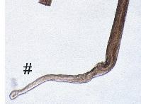 (konzervační látka v potravinách), thalium (hubení hlodavců), DDT, enzymové inhibitory