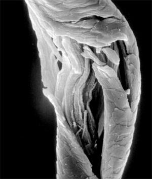 Trichopoliodystrofie syn.