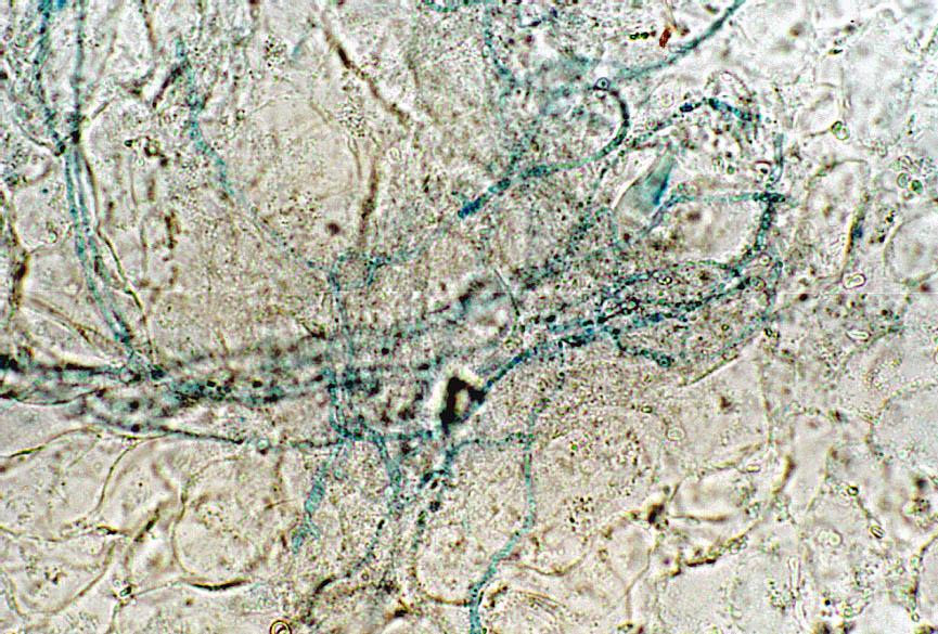 Microsporum Mycelium hyfy