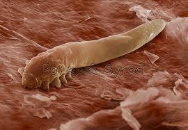 Trudník tukový (Demodex