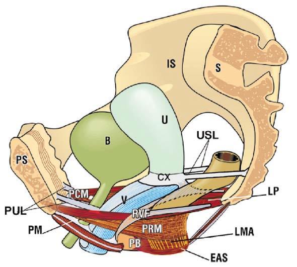 Virtuální model pánevního dna simulace prolapsu vnitřních orgánů 2016 B) Anteverse je natočení dělohy dopředu kolem horizontální frontální osy, takže tělo dělohy je nakloněné dopředu.