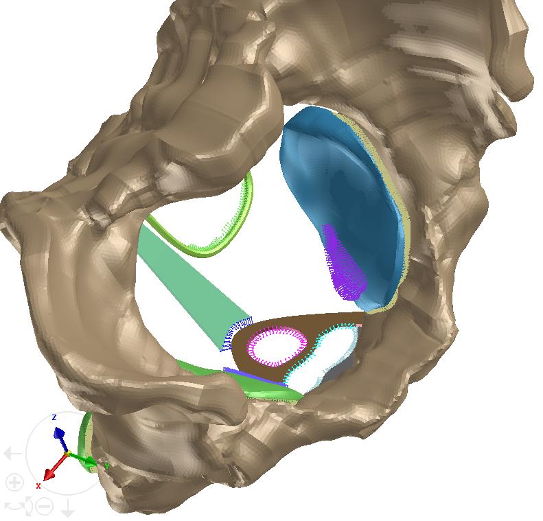 Virtuální model pánevního dna simulace prolapsu vnitřních orgánů 2016 které jsou nahrazeny tělesy destičkového tvaru s otvory pro upínání vagíny a konečníku v její kaudální časti, kde tyto orgány