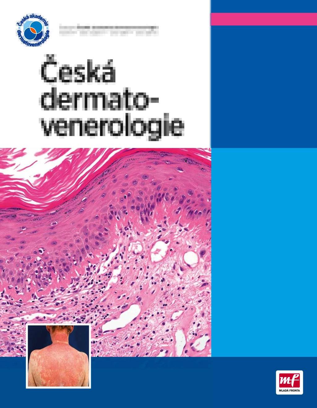 Časopis České akademie dermatovenerologie ročník 7 číslo vydání 1 únor 2017 cena 125 Kč Česká dermatovenerologie TÉMA ČÍSLA 2017/1 Lupus erythematodes