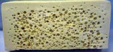 Kmen Escherichia coli 0157:H7 byla poprvé identifikován v roce 1982. Je hlavní příčinou alimentárních onemocnění. Je to velice nebezpečný lidský patogen, především pro malé děti.