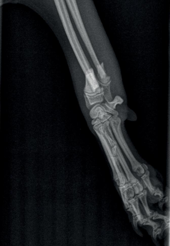 předimenzovanému 2,7mm implantátu