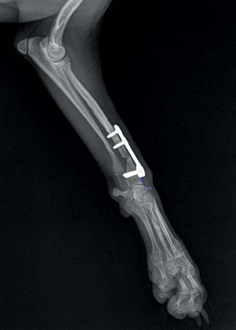 Obr. 6 Intraoperační nález Fixin