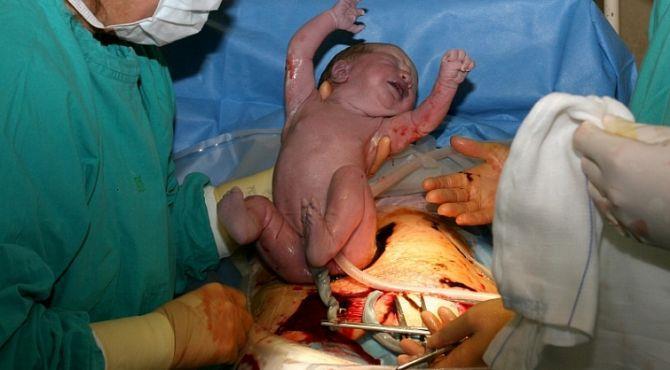 anesteziolog řirozený porod
