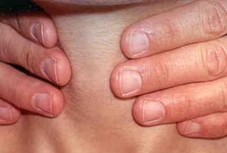 Diagnostika AT-v podstatě se neliší od ostatních tyreopatií Anamnéza Fyzikální vyšetření Ultrazvuk Stanovení hormonálních hladin (funkce š.ţ.