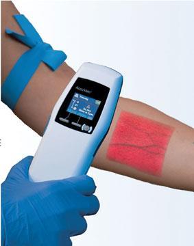 Accuvein -