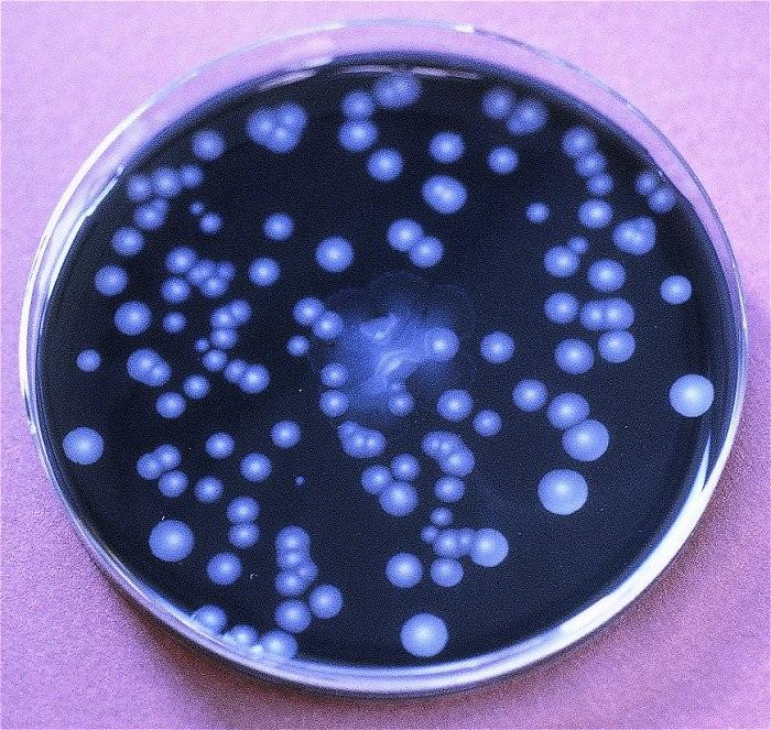 BCYE agar pro legionely Buffered Charcoal Yeast