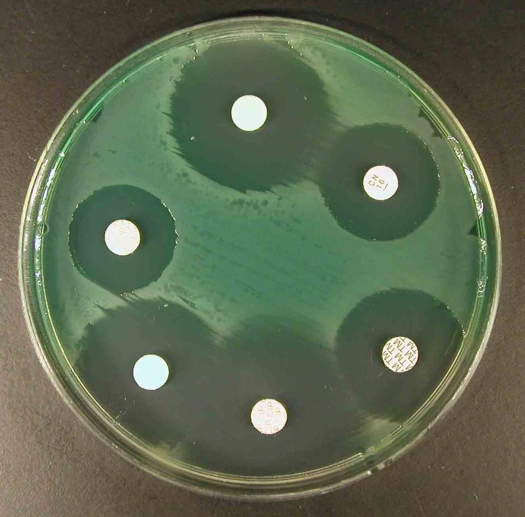 Na obrázku je Pseudomonas aeruginosa pravděpodobně citlivá na všechna testovaná antibiotika; je to však možné jen proto, že jsou testována jen speciální protipseudomonádová léčiva.