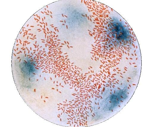 Kdo to Kubíkovi udělal? Viník: Haemophilus influenzae ser.