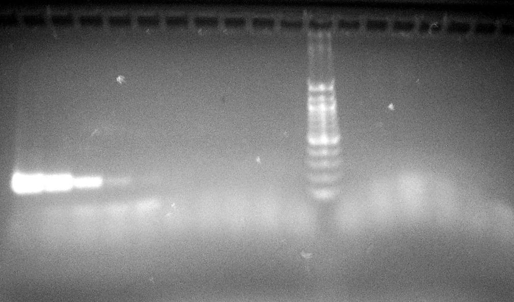 1 2 3 4 5 6 7 8 9 10 11 12 13 14 15 16 17 250 bp Obr. 32: Agarosová gelová elektroforéza PCR produktů (250 bp) příslušných supernatantů po izolaci DNA magnetickou separací (L.
