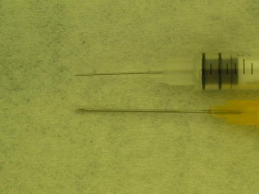 Výsledky - leukoplakie Studie zahrnovala celkem 66 pacientů, kteří byli zahrnuti do studie podle výše uvedených kritérií, léčeno bylo celkem 76 lézí leukoplakií.