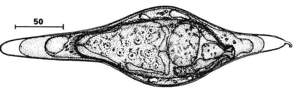Obr. 3 Vajíčko (Trichobilharzia regenti);