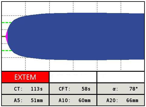 jsou následovné: CT 38-79s; CFT 34-159s; uhel α 63-83 ; MCF