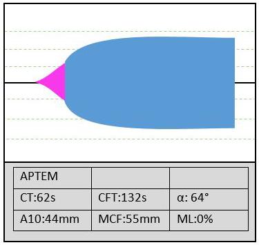 testem APTEM (obsahuje antifibrinolytikum)  13