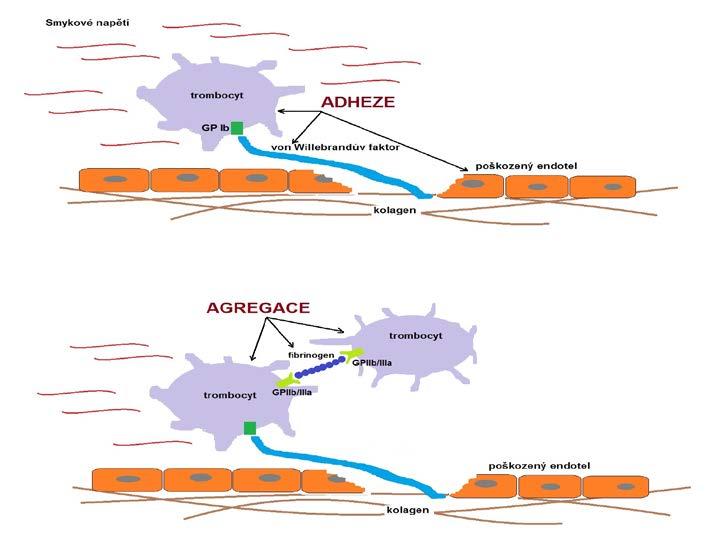 Obr. č. 1 Tvorba trombocytární zátky primárná hemostáza Pokud je nějaká patologie na úrovni tohoto systému, např. porucha vasokonstrikce v místě zánětu či jiné příčiny (teleangiektázie.