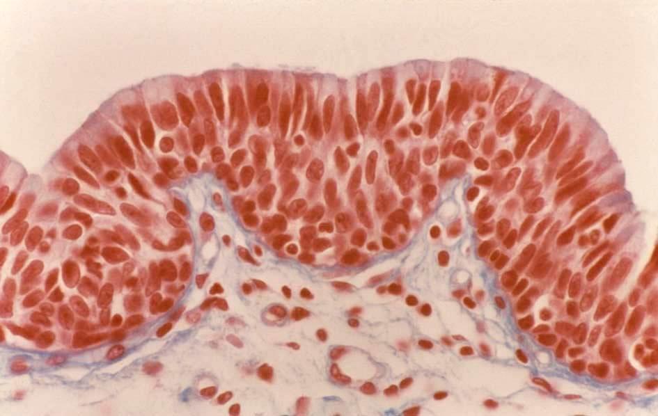 fornix conjunctivae epitel přechodních zón kde vrstevnatý