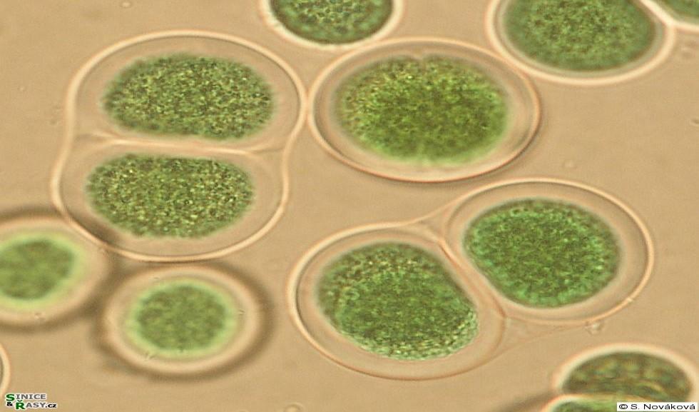 Bakterie s buněčnou stěnou gramnegativního typu Kmen Cyanobacteria Třída Cyanobacteria Pododdělení I.