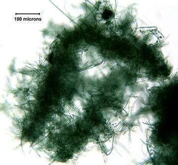 Bakterie s buněčnou stěnou gramnegativního typu Calothrix Kmen Cyanobacteria Třída Cyanobacteria Pododdělení IV.