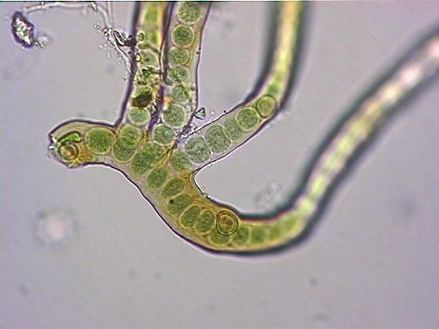 Bakterie s buněčnou stěnou gramnegativního typu Kmen Cyanobacteria Třída Cyanobacteria Pododdělení V.