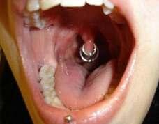 Příloha 2 Piercingy